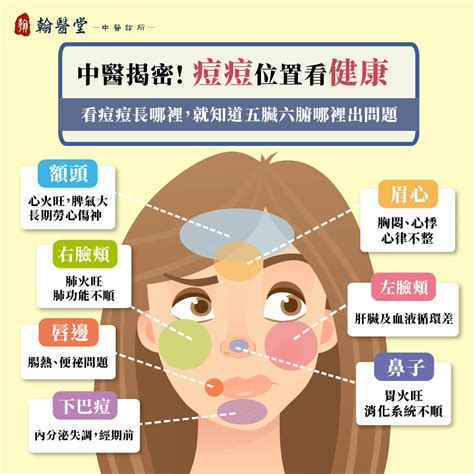 痘痘長得位置|額頭、下巴狂長痘痘？痘痘位置反映的健康問題與保養對策